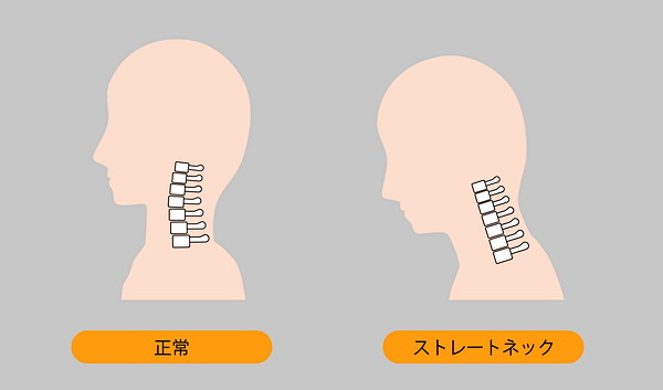 首の構造